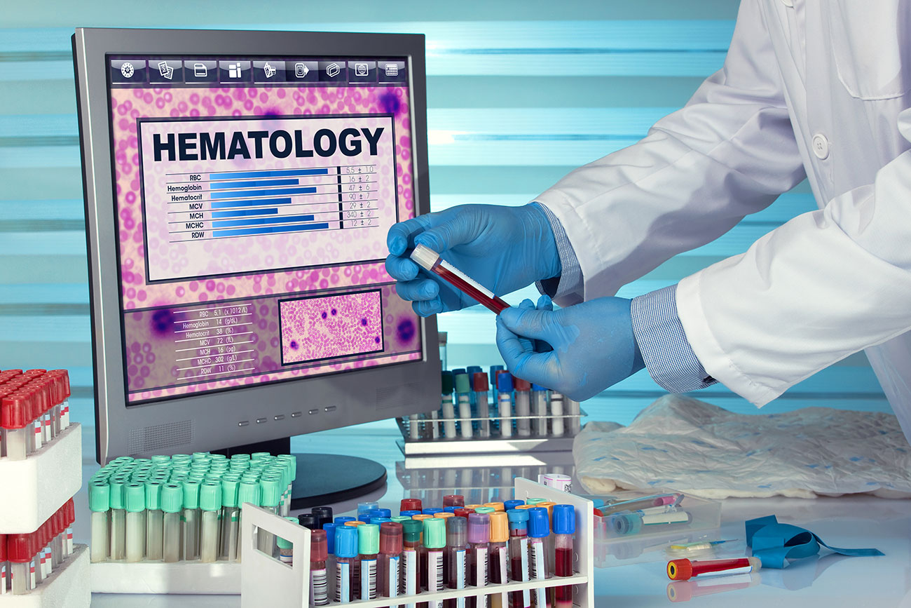 Hematology Lab