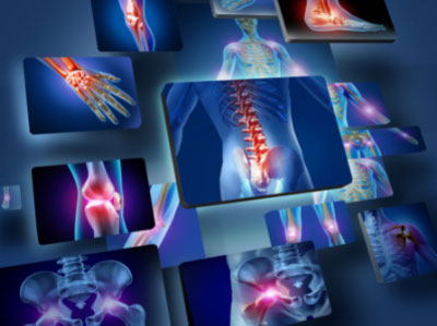 Orthopedic